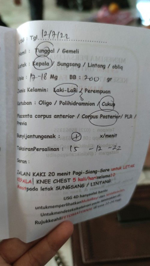 Plasenta corpus posterior