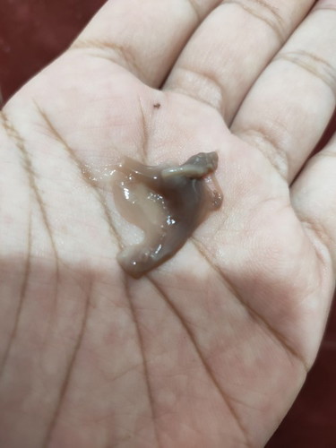 Darah coklat kenyal² adekah tanda bersalin?37w bukaan 2cm,doc srh balik dlu.skrg da 37w4d.