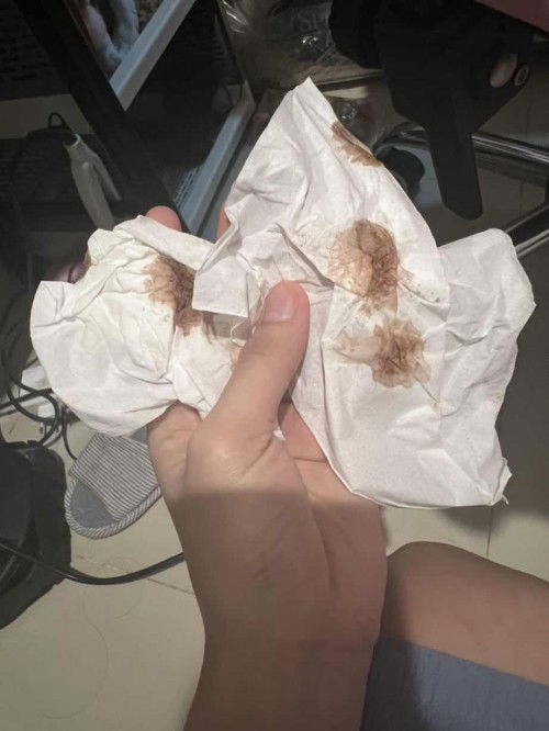 Hamil 14 week keluar flek