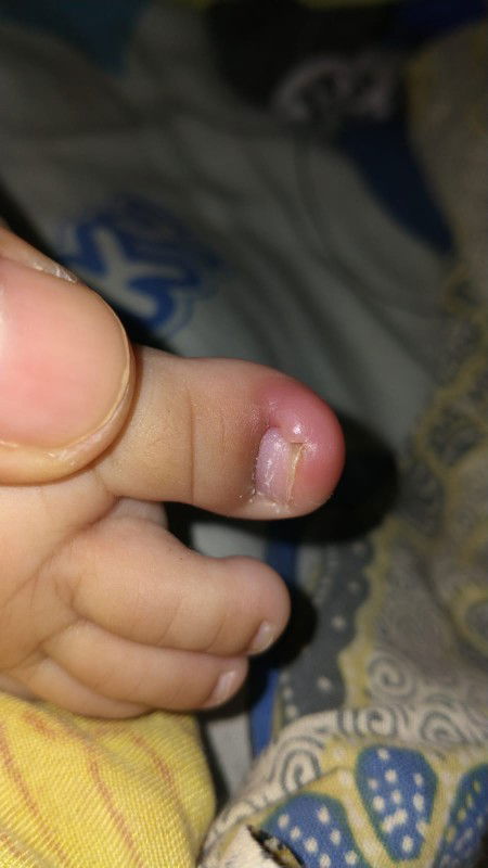 Bun mau nanya dong rekomendasi obat/salep buat anakku. Kakinya kaya gitu
Terimakasih sebelumnya bun?