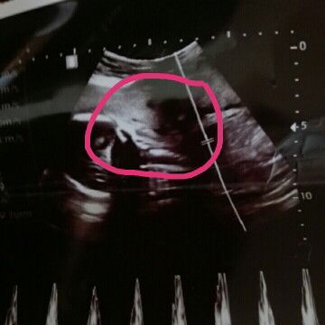 สอบถามแม่ๆค่ะ