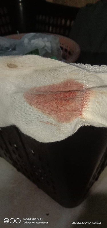 Maaf Bun. Td pagi flek coklat gelap. Trs barusan keluar darah segar. Tnya bidan disuruh nunggu dan