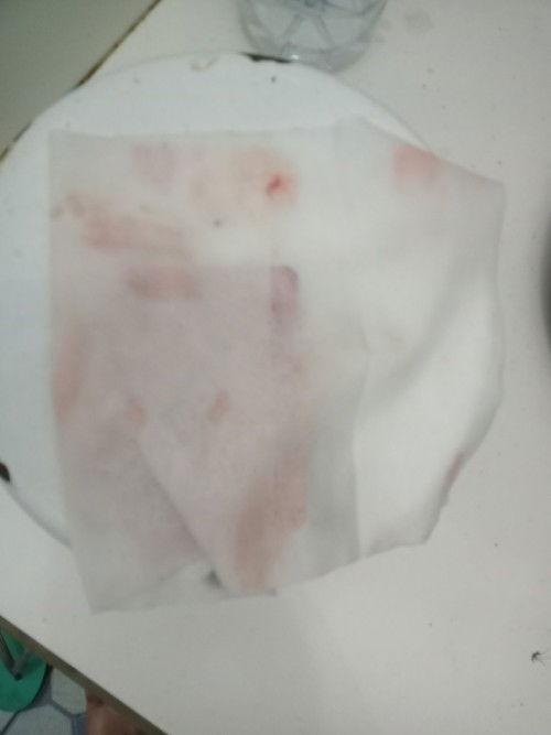 Muncul bercak kaya gtu tiap hb bahaya ga sih bun? Tp stlahny udh ga kluar2 lg