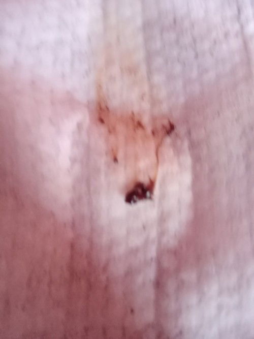 เลือดออกเหมือนประจำเดือน