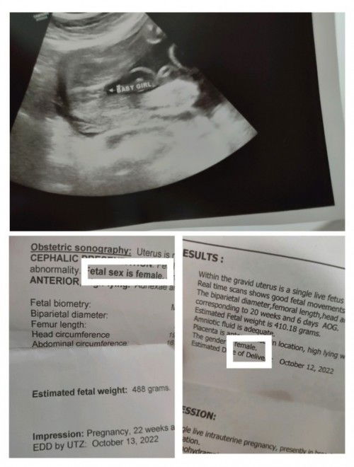 Mga mamsh ☺️ Sure naman na po siguro na baby girl na talaga? Dumadating na kasi paisa-isa mga order