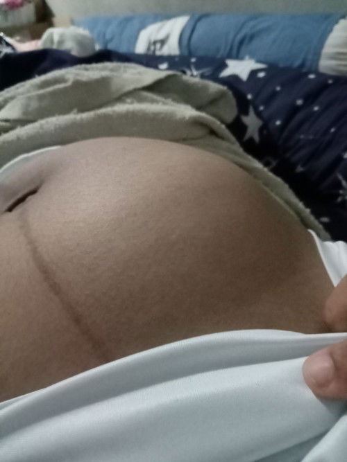 ท้องปั้นบ่อย ไม่มีน้ำเดิน ไม่มีมูกเลือด