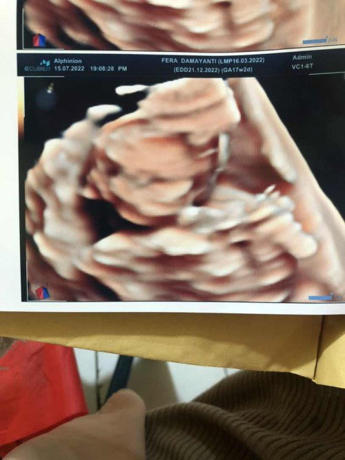 Makan pedes rambut baby jarang mitos/fakta
