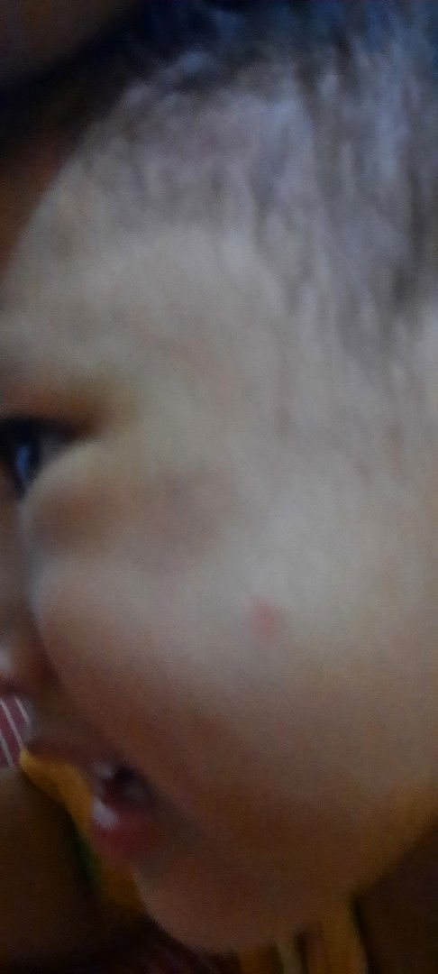 Cara menghilangkan warna kulit yg tidak rata gmna yaa bun..