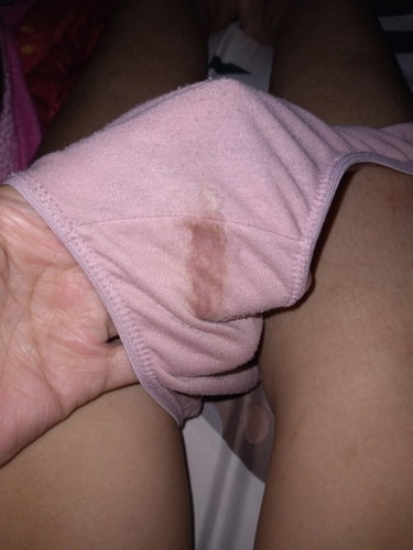 Spotting while pregnant
