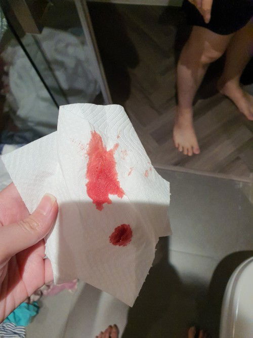 ท้อง3เดือนเลือดออกสีแดงสด มีท่านไหนเป็นบ้างคะ