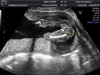 แม่ว่าหญิงไหม้ค่ะ