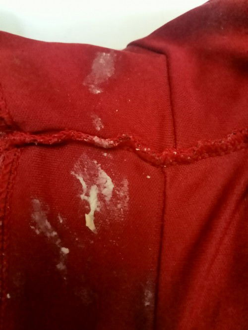 ตกขาวแบบนี้ควรไปหาหมอไหมค่ะ