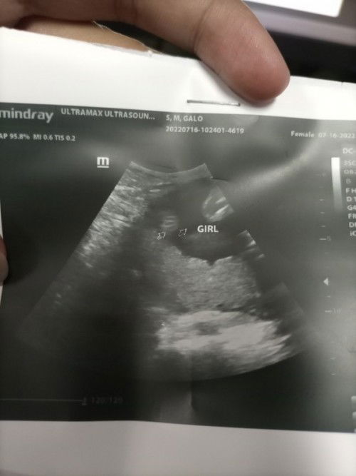 GENDER Sure na po ba ??