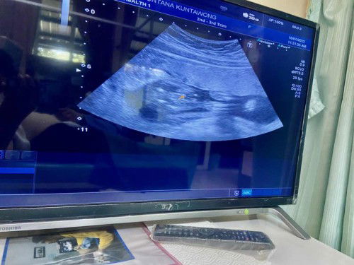 แม่ๆว่าน้องเพศอะไรคะ