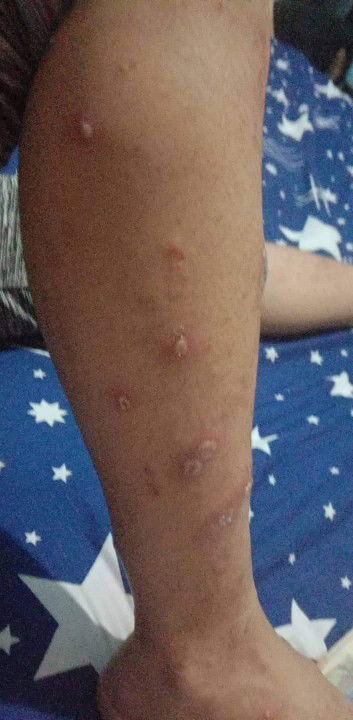 Ano po kaya pwede igamot?21 weeks pregnant po.salamat sa sasagot🙂