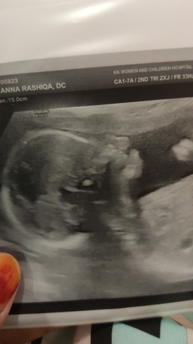 20wk pregnant