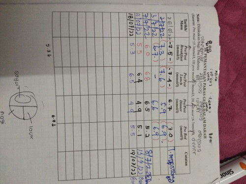 GDM ON UBAT & INSULIN