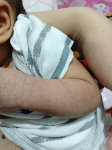 ibang kulay ng balat ni baby