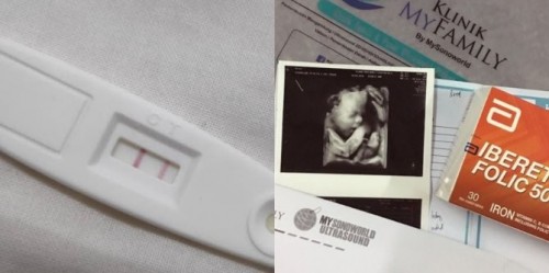Pengalaman Mengandung Anak Pertama! Lain macam simptomnya...