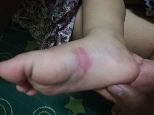 Anu po kaya itong pula sa paa ng baby ko