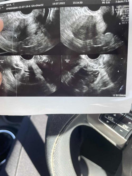 penebalan dinding rahim