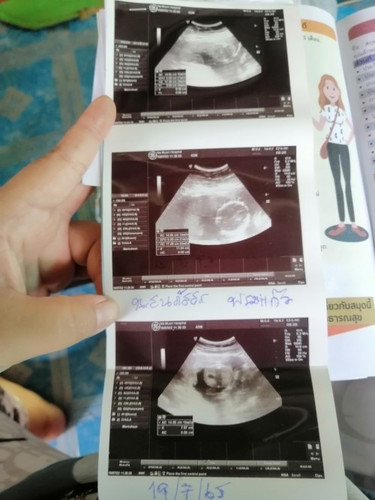 อยากทราบเพศลูก