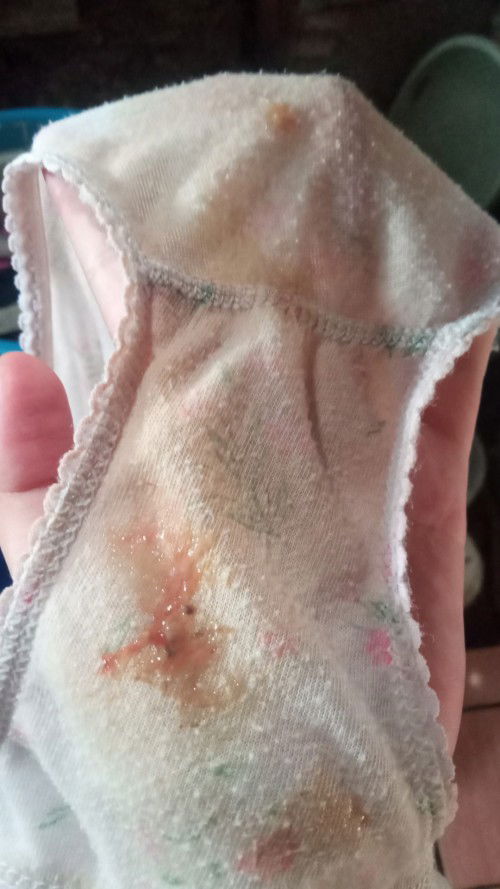 Mau tanya dong bun maaf aga jorok