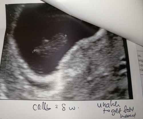 BUKA BUKU PINK TANPA KEGEMBIRAAN