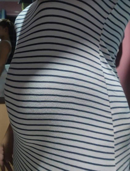 hello po mga mommies plss help! sobrang mamaga Ang gums Ng ipin ko ano pobang dapat Gawin 4 month🤰