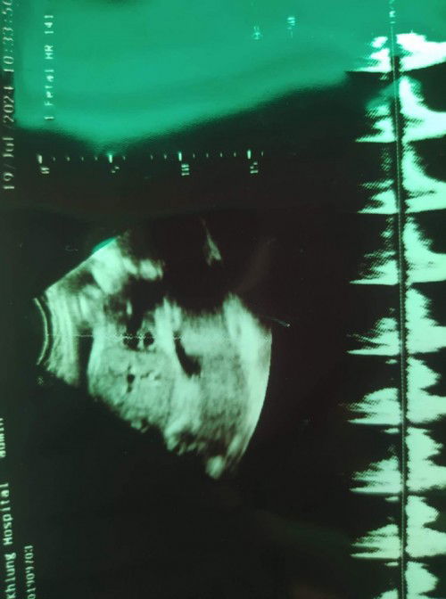 #ท้องแรกค่ะ