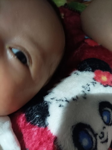 Saran donk bunda.. Mata kiri anak saya matanya berair dan mengeluarkan kotor an sejak lahir...