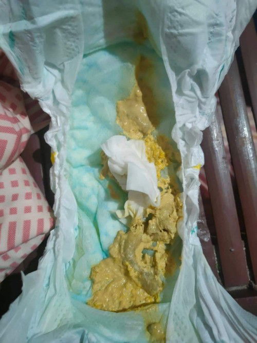 Ganito po poop ni baby ngayon.