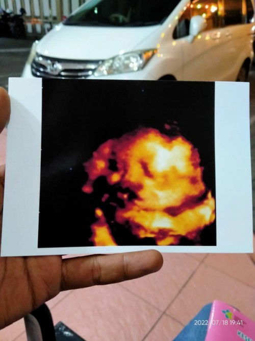 Tanya dan sharing seputar JK baby bun...