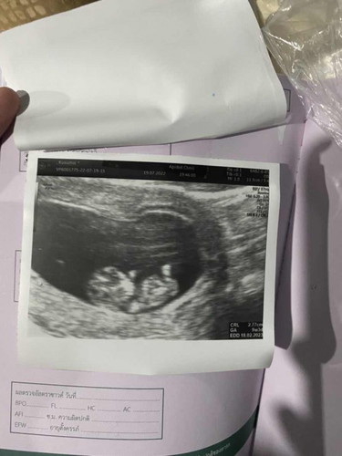 9week 3b ❤️❤️❤️
