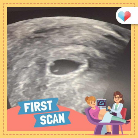 first scan today