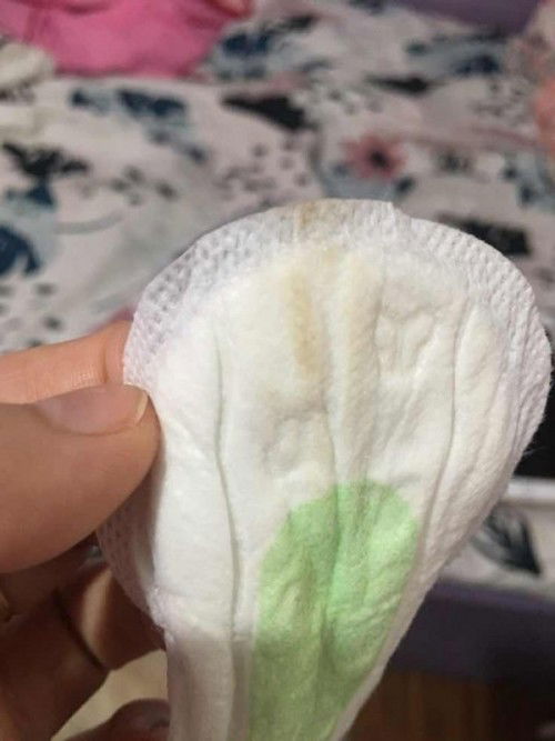 Brown spotting help po.