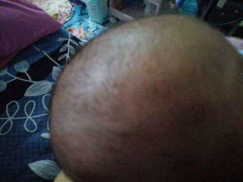 Knp kepala baby sy tumbuh bintik2 mcm ni ye