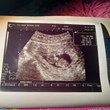 Normalkah hasil USG 11 minggu segitu bunda..?karena berat badan saya turun yg awalnya 61 jdi 59