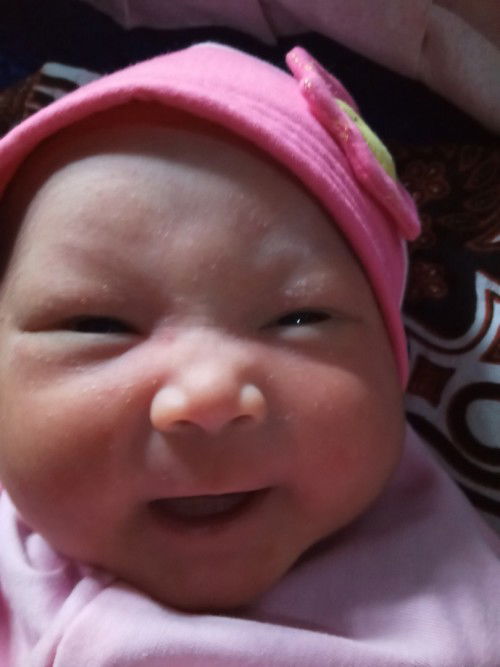 Gimna ya menghilangkan bintik2 putih pada bayi