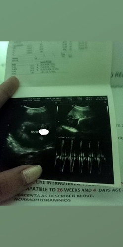 Gender Ultrasound