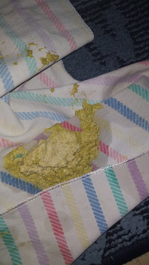 Feses Bayi pucat setelah imunisasi Penta3