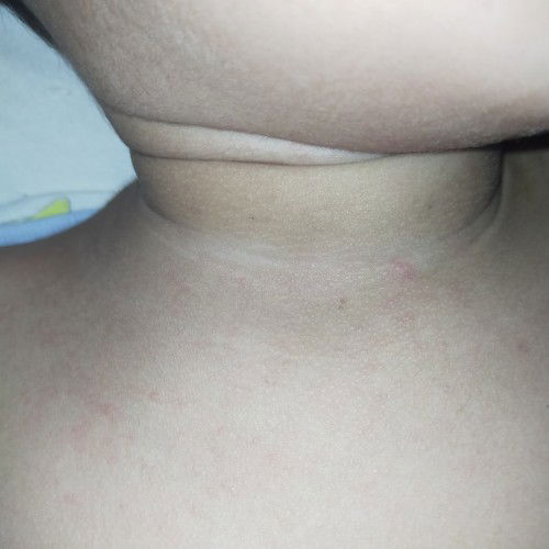 ano po ang ma iadvise nyu mommies nag aalala na po ako