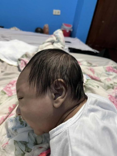 Dapil na ulo ni baby