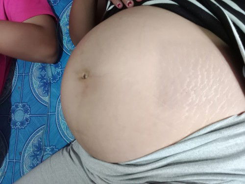 ลักษณะท้องแบบนี้ ช หรือ ญ ค่ะ
24+6วีคแฝดจร้า