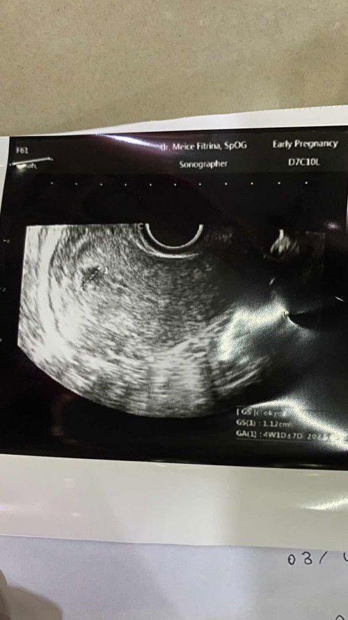 Bentuk Kantong kehamilan bergerigi seperti bintang