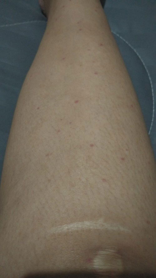 สอบถามแม่ๆ