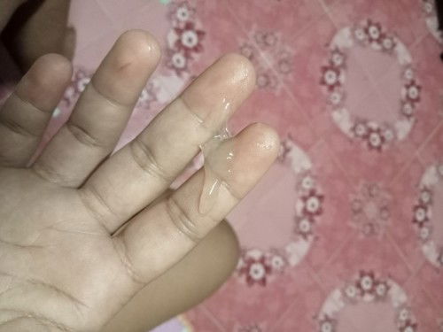 มีมูกใสออกมา รวมด้วยเจ็บท้องเหมือนเป็นประจำเดือน เจ็บหายๆเป็นพักๆ ไม่ทราบว่าเจ็บท้องเตือนมั้ยค่ะ