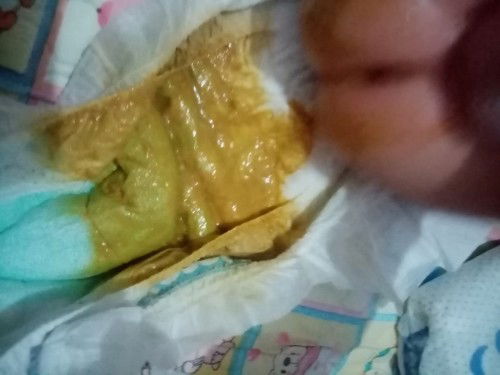 Poop ni baby