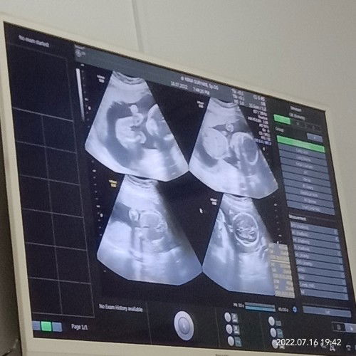 𝙷𝚙𝚕 𝙽𝚘𝚟𝚎𝚖𝚋𝚎𝚛