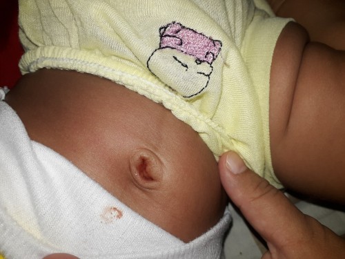 pusar bayi msh basah sudah 3 bulan ini, kadang warnanya kuning kehijauan kdg coklat terang sprti itu